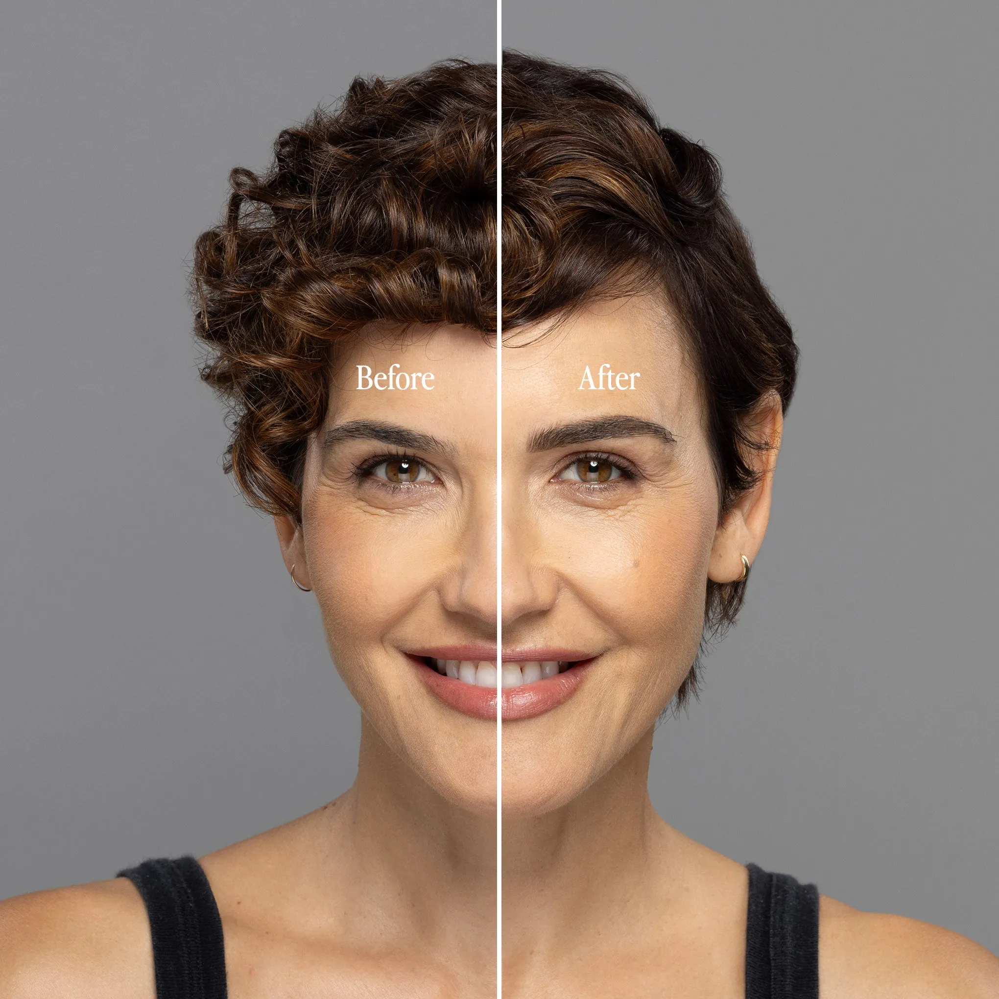 Billion Dollar Brow Lift