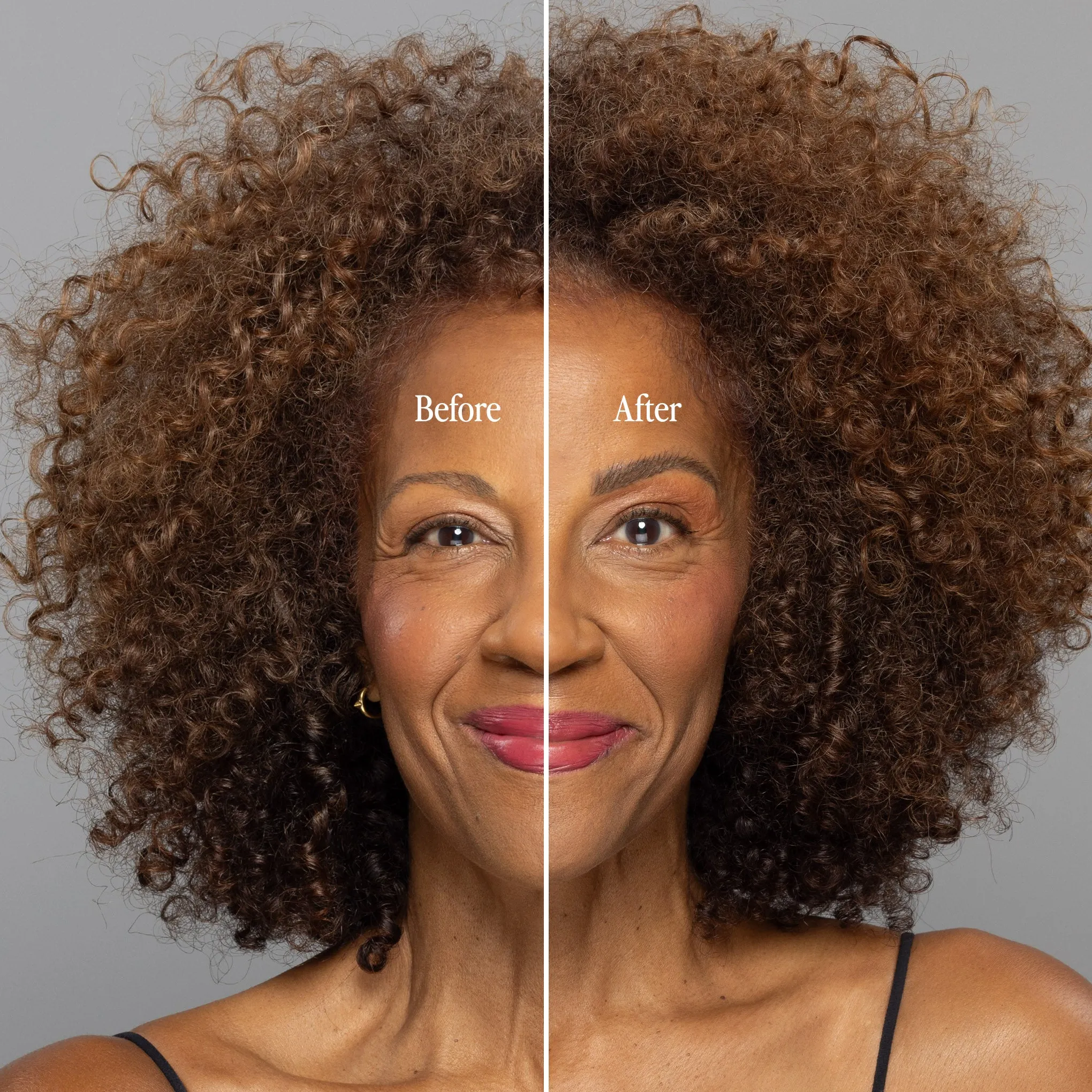 Billion Dollar Brow Lift