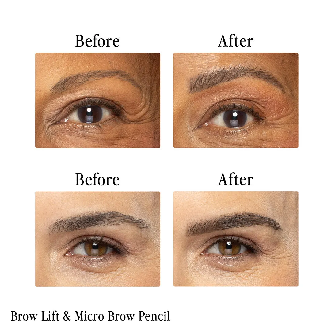 Billion Dollar Brow Lift