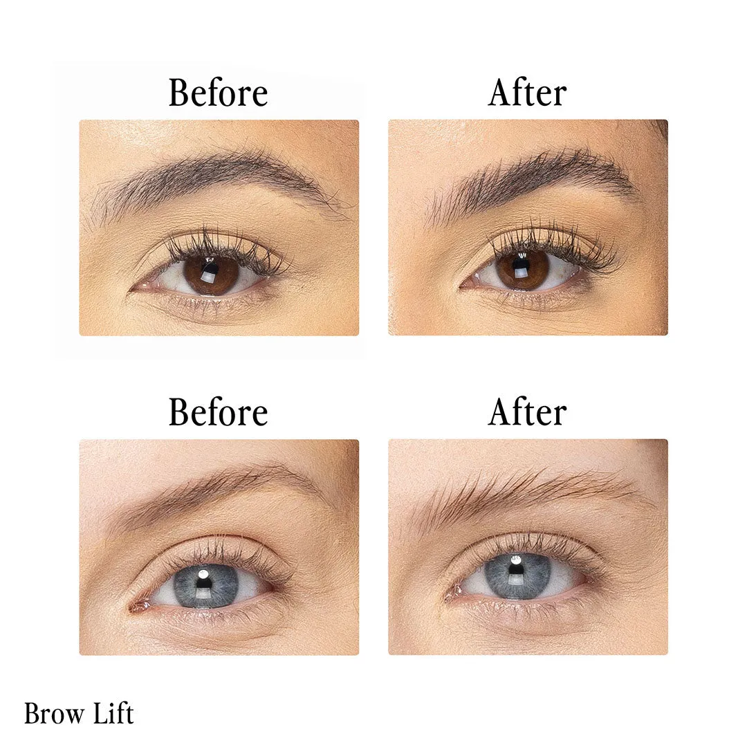 Billion Dollar Brow Lift