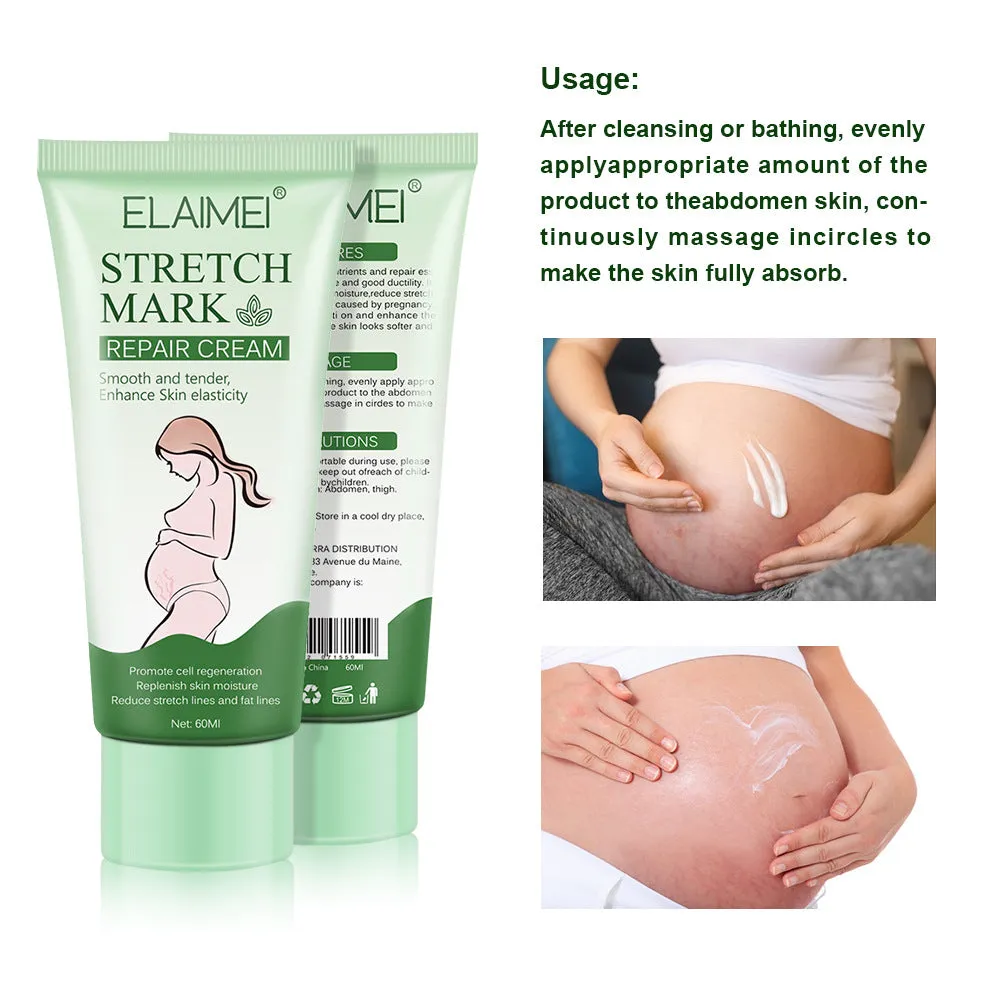 Stretch Mark Repair Cream Smooth Tender Enhance Skin Elastictiy Acne Repair 60ml Anti-Aging Cream Pregnancy Scars