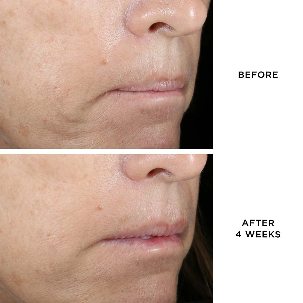 THE DEWY SERUM