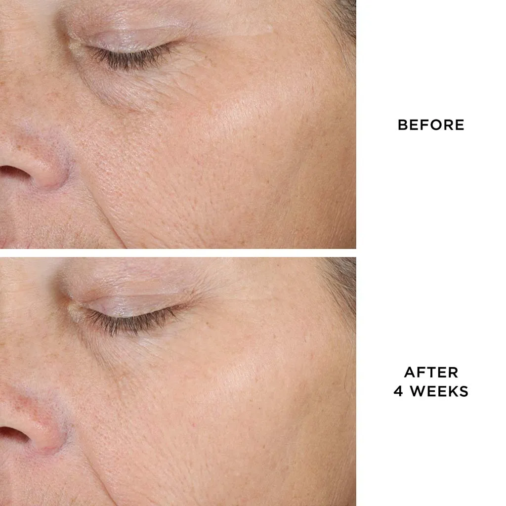 THE DEWY SERUM