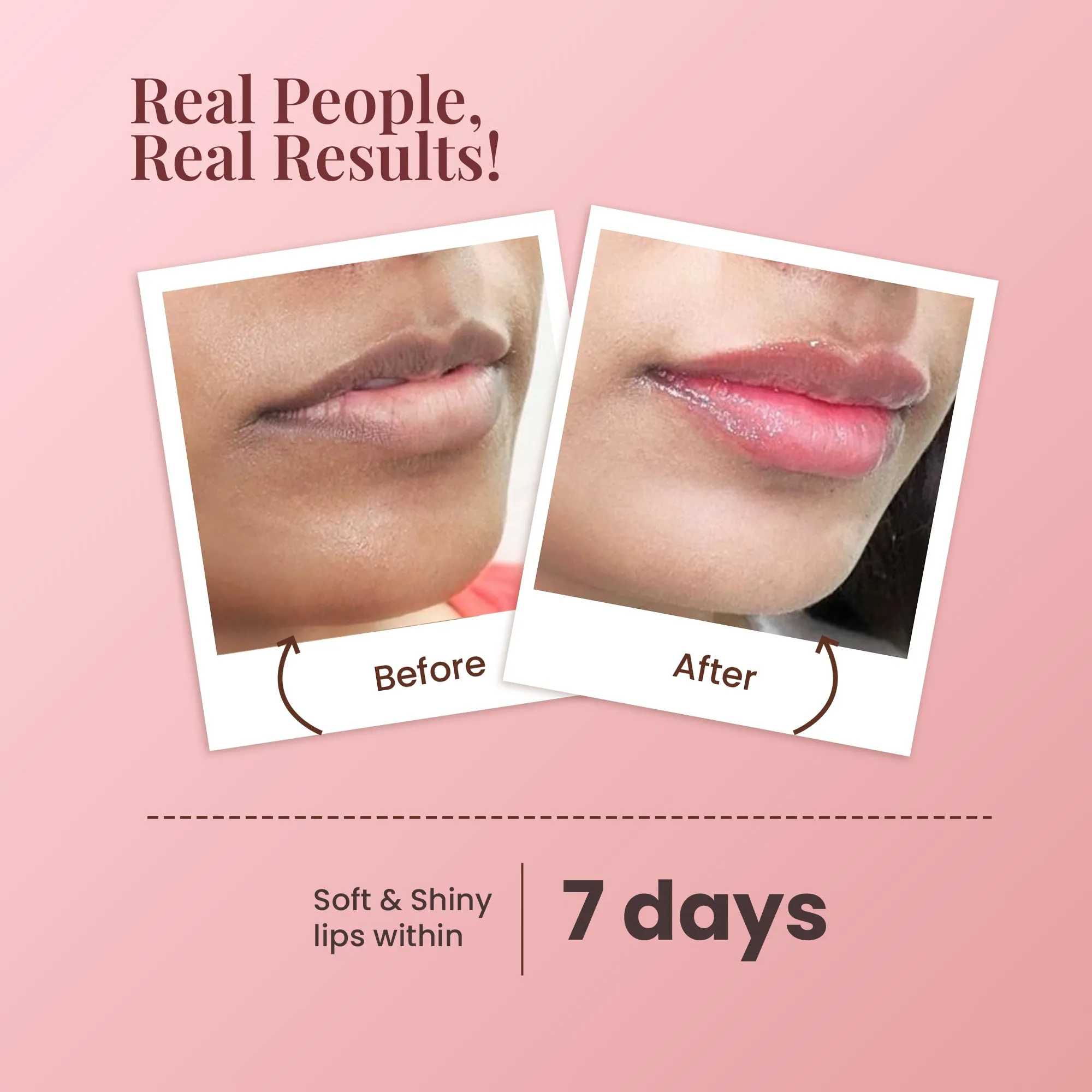 Vanilla Lip Care with White Haldi for Shiny and Hydrated Lips